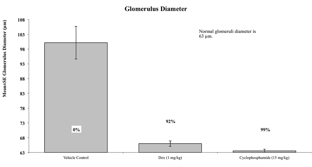 SLE8-Glomerulus-Diameter-Histo
